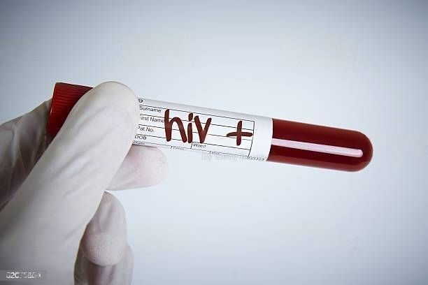 couples must take an HIV test